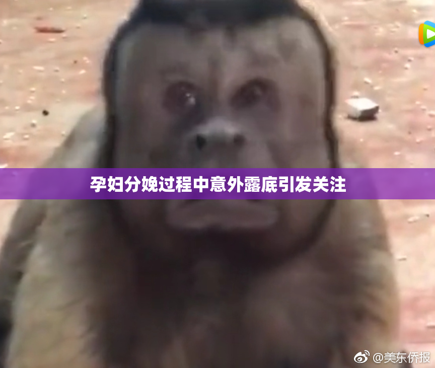 孕妇分娩过程中意外露底引发关注