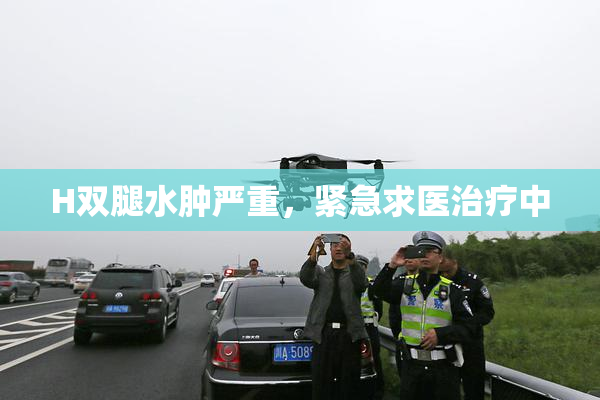 H双腿水肿严重，紧急求医治疗中