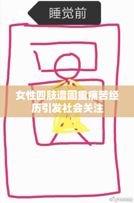 女性四肢遭固重痛苦经历引发社会关注