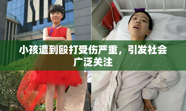 小孩遭到殴打受伤严重，引发社会广泛关注