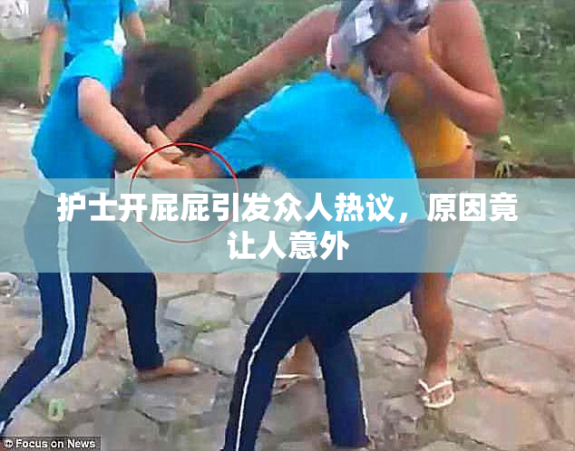 护士开屁屁引发众人热议，原因竟让人意外