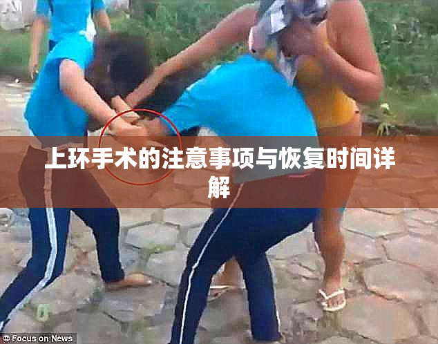 上环手术的注意事项与恢复时间详解