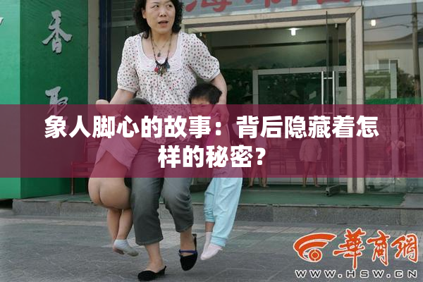 象人脚心的故事：背后隐藏着怎样的秘密？