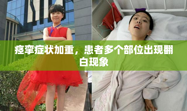 痉挛症状加重，患者多个部位出现翻白现象