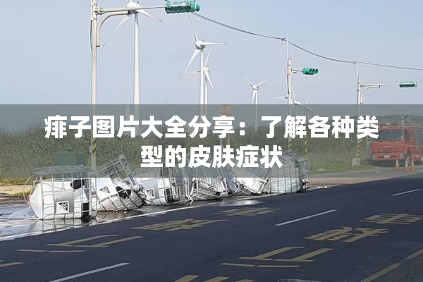 痱子图片大全分享：了解各种类型的皮肤症状
