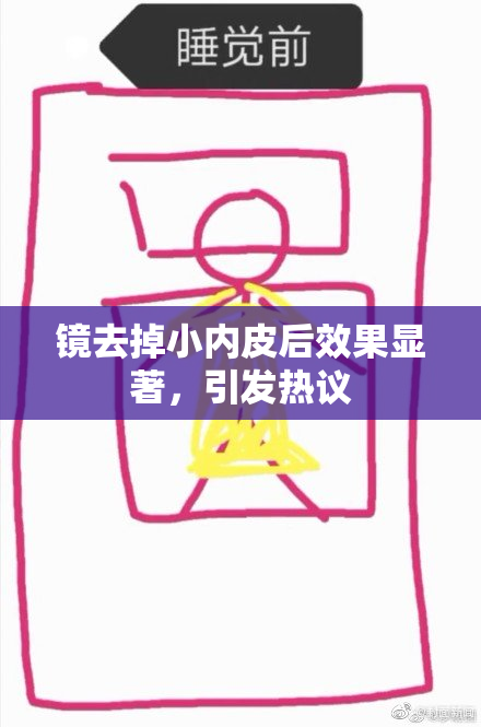 镜去掉小内皮后效果显著，引发热议