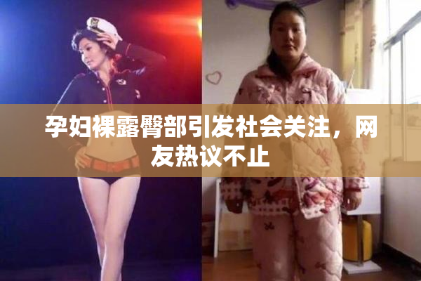 孕妇裸露臀部引发社会关注，网友热议不止