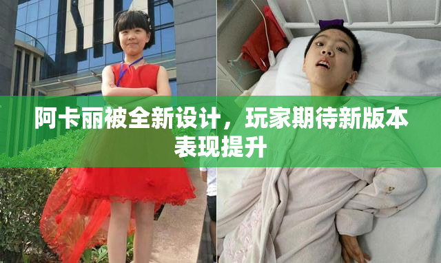 阿卡丽被全新设计，玩家期待新版本表现提升