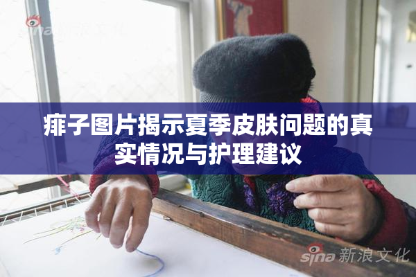 痱子图片揭示夏季皮肤问题的真实情况与护理建议