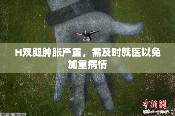 H双腿肿胀严重，需及时就医以免加重病情
