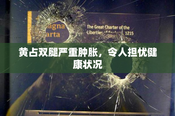 黄占双腿严重肿胀，令人担忧健康状况