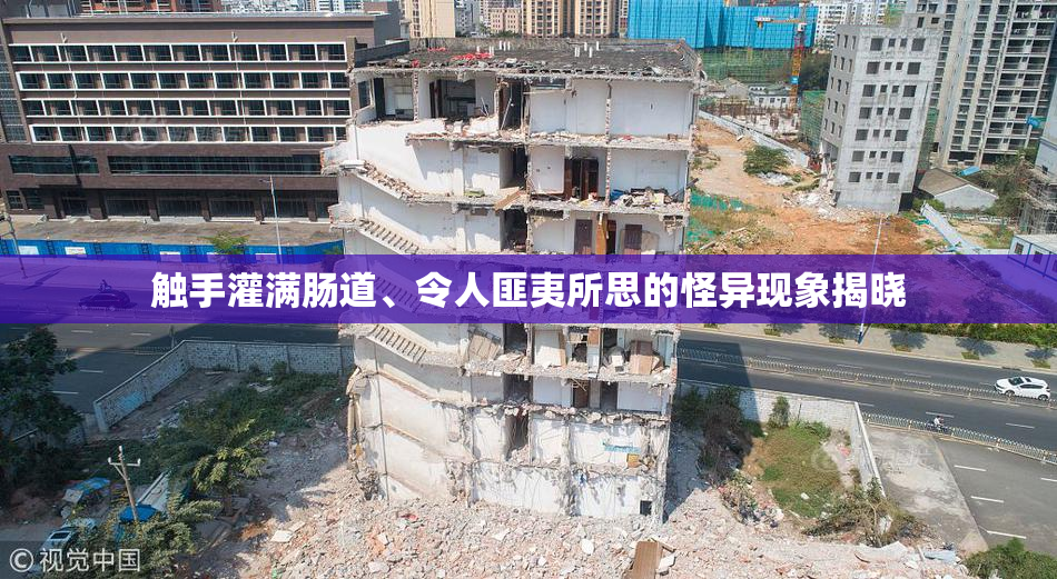触手灌满肠道、令人匪夷所思的怪异现象揭晓